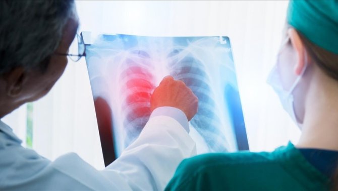 Kanseri ‘MAT’ edecek buluş